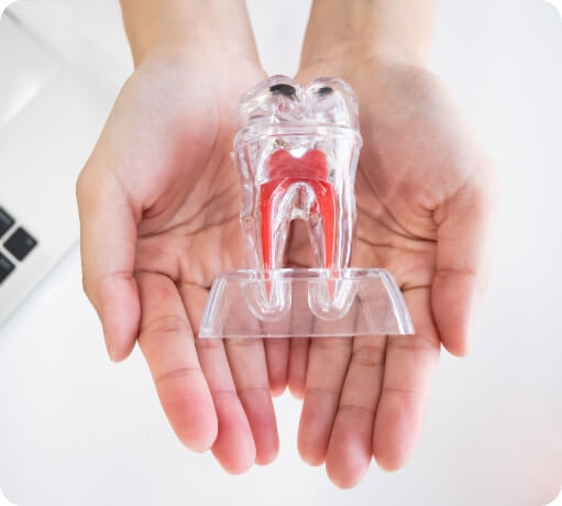 Model tooth used to explain root canal treatment