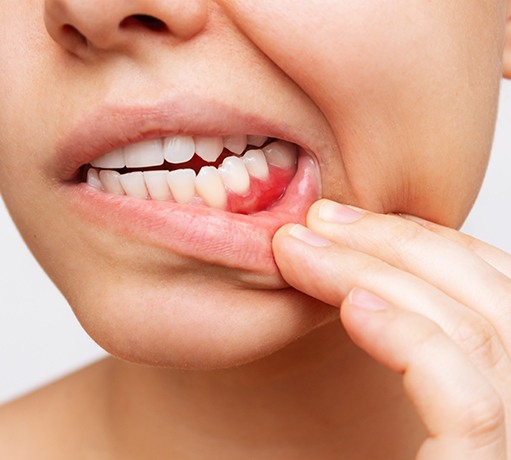 Animated smile during scaling and root planing treatment