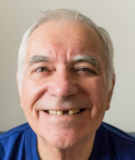 Smiling man in need of replacing missing teeth