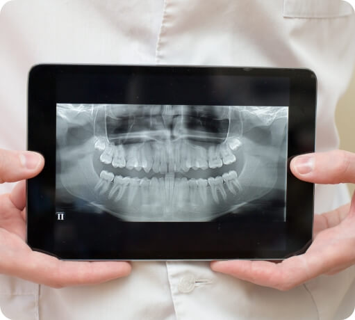 Dentist showing digital x rays on tablet computer
